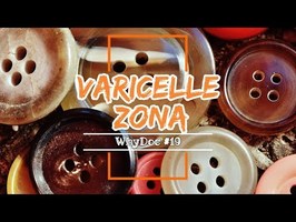 Varicelle et Zona - WhyDoc #19