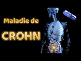 La Maladie de Crohn - CP#7